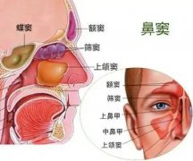 【全國愛鼻日】孩子出現(xiàn)這些癥狀，警惕鼻竇炎！